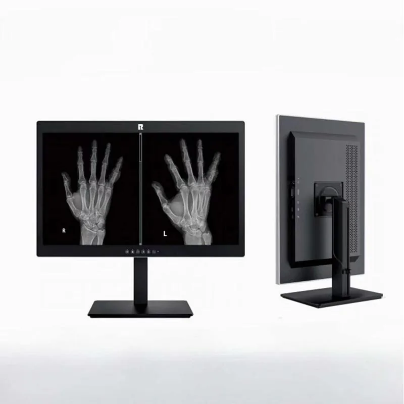 20,1-tums 2MP medicinsk diagnostisk display