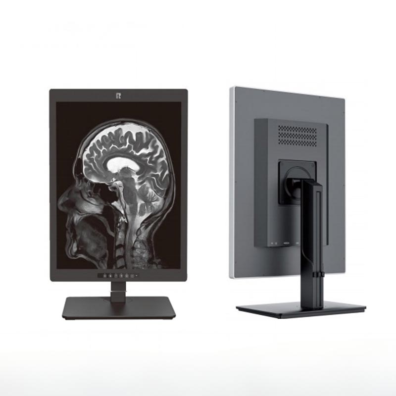 20,1-tums 2MP medicinsk diagnostisk monitor