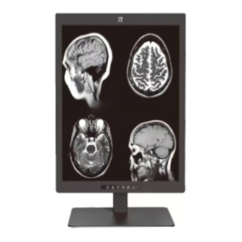 21,3-tums 3MP medicinsk diagnostisk display