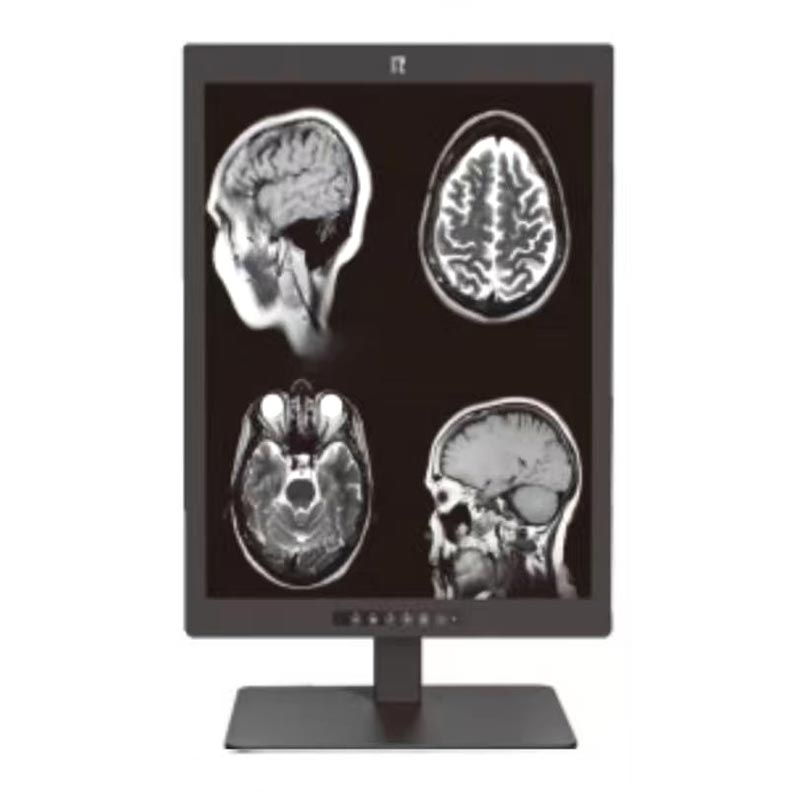 21,3-tums 3MP medicinsk diagnostisk monitor