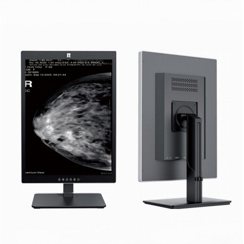 21,3-tums 5MP medicinsk diagnostisk monitor