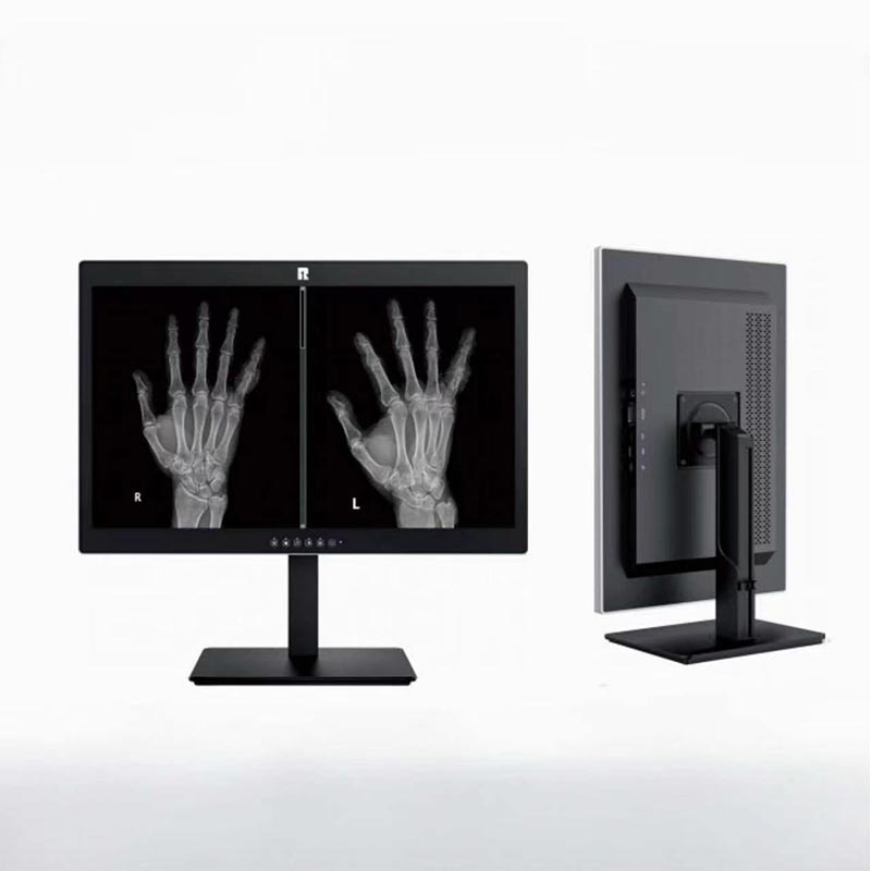 24-tums 2MP medicinsk diagnostisk monitor