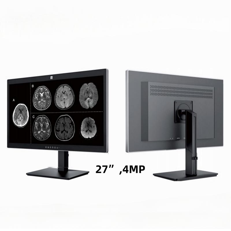 27-tums 4MP medicinsk diagnostisk display