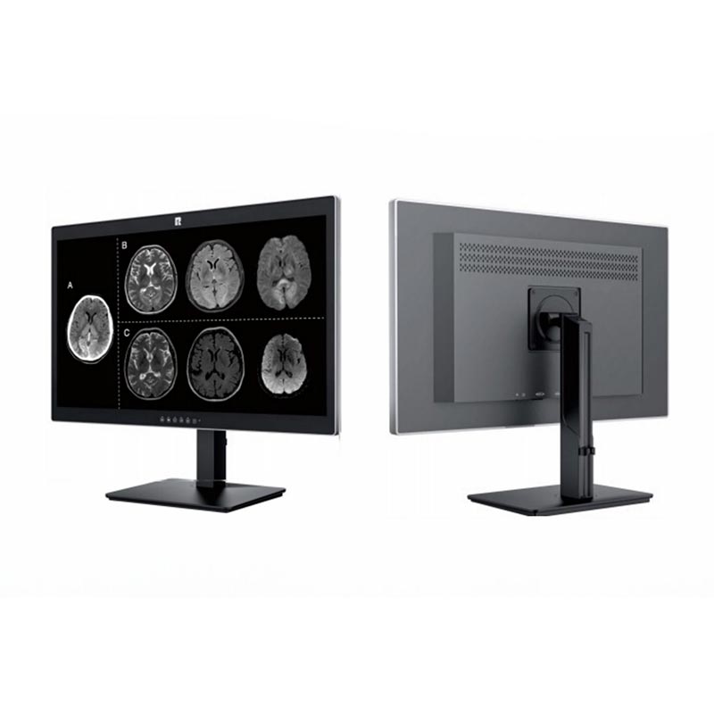 27-tums 8MP medicinsk diagnostisk display
