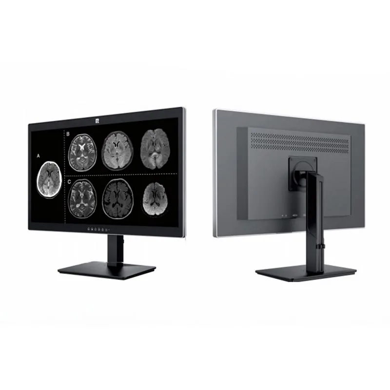 27-tums 8MP medicinsk diagnostisk monitor