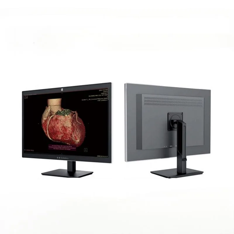 30-tums 6MP medicinsk diagnostisk monitor