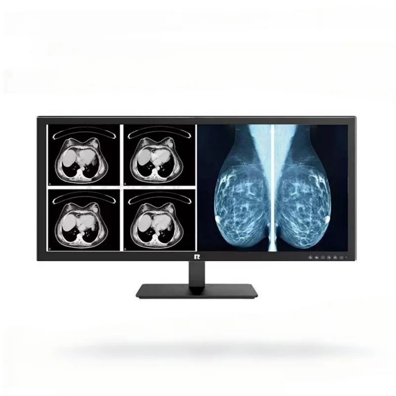 34-tums 5MP Medical Diagnostic Monitor