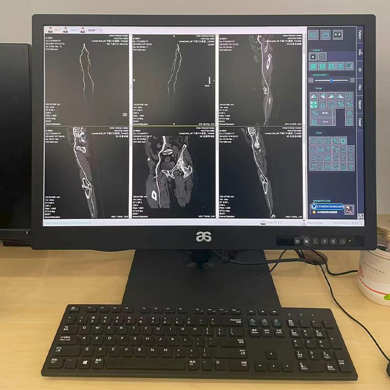 24-inch 2MP Medical Diagnostic Monitor