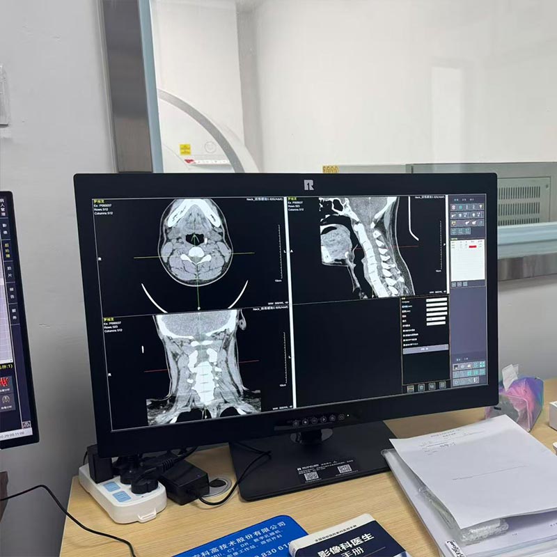 24-inch 2MP Medical Diagnostic Monitor