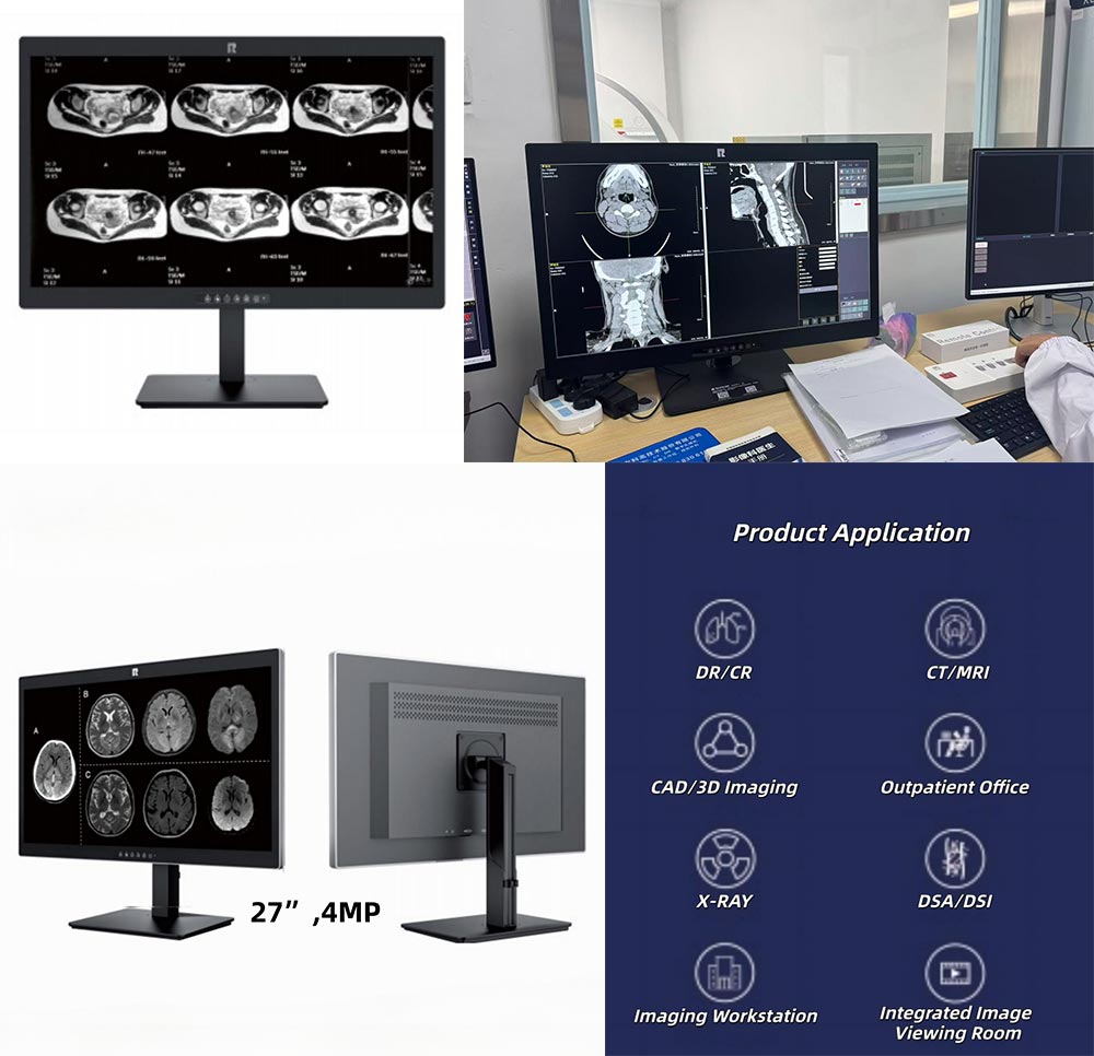 27-inch 4MP Medical Diagnostic Display